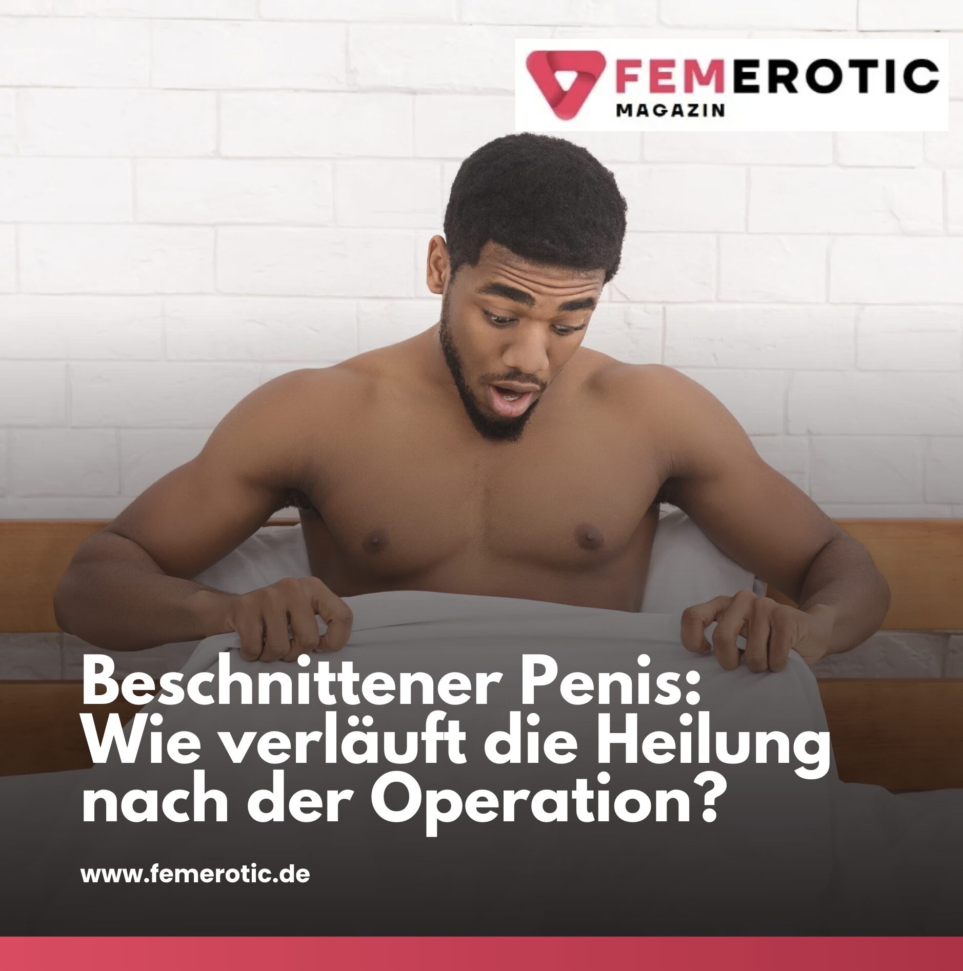 Beschnittener Penis: Wie verläuft die Heilung nach der Operation? Beschnittener Penis: Wie verläuft die Heilung nach der Operation?