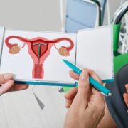 Kann man trotz Spirale schwanger werden Zwischen sicherer Verhütung und wachsender Unsicherheit